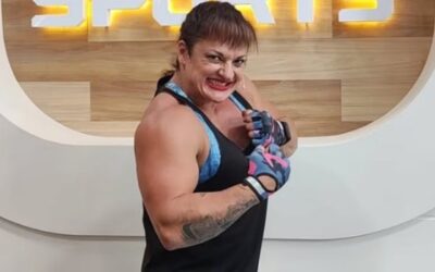 “Locomotora” Oliveras sigue en  estado crítico y con pronóstico  reservado: “no presentó evolución médica, tiene obstrucción arterial”
